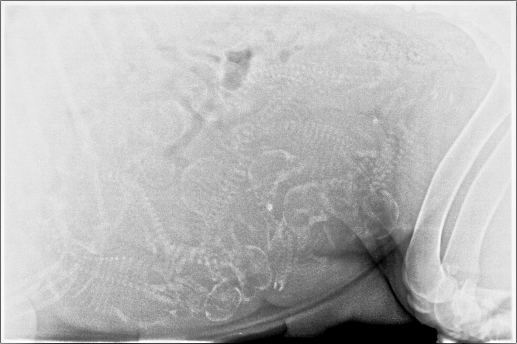 Cami xray